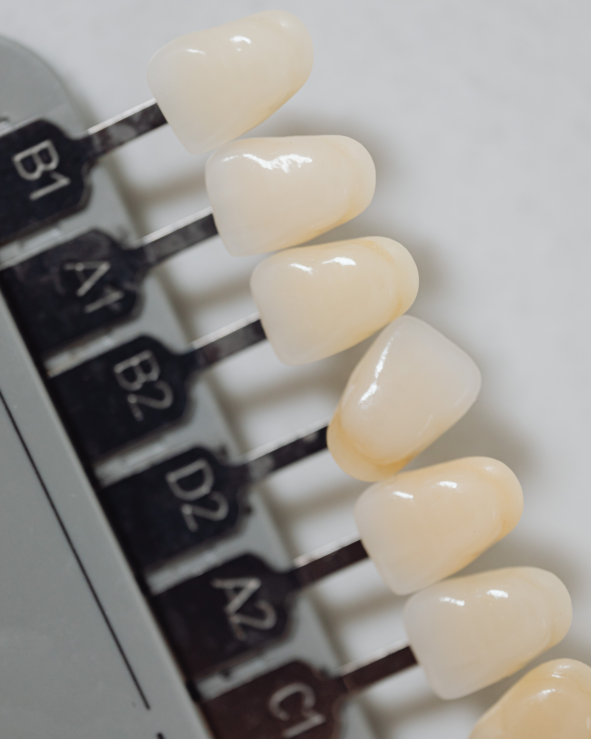 Estetică Dentară Lemon Dent